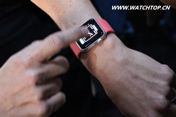 AppleWatch用戶“就醫指南”公布 戴表別戴成奇葩 就醫指南 applewatch 熱點動態  第2張